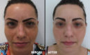 Peeling intermediar plus, in 3 etape6 Peeling intermediar plus, in 3 etape6
